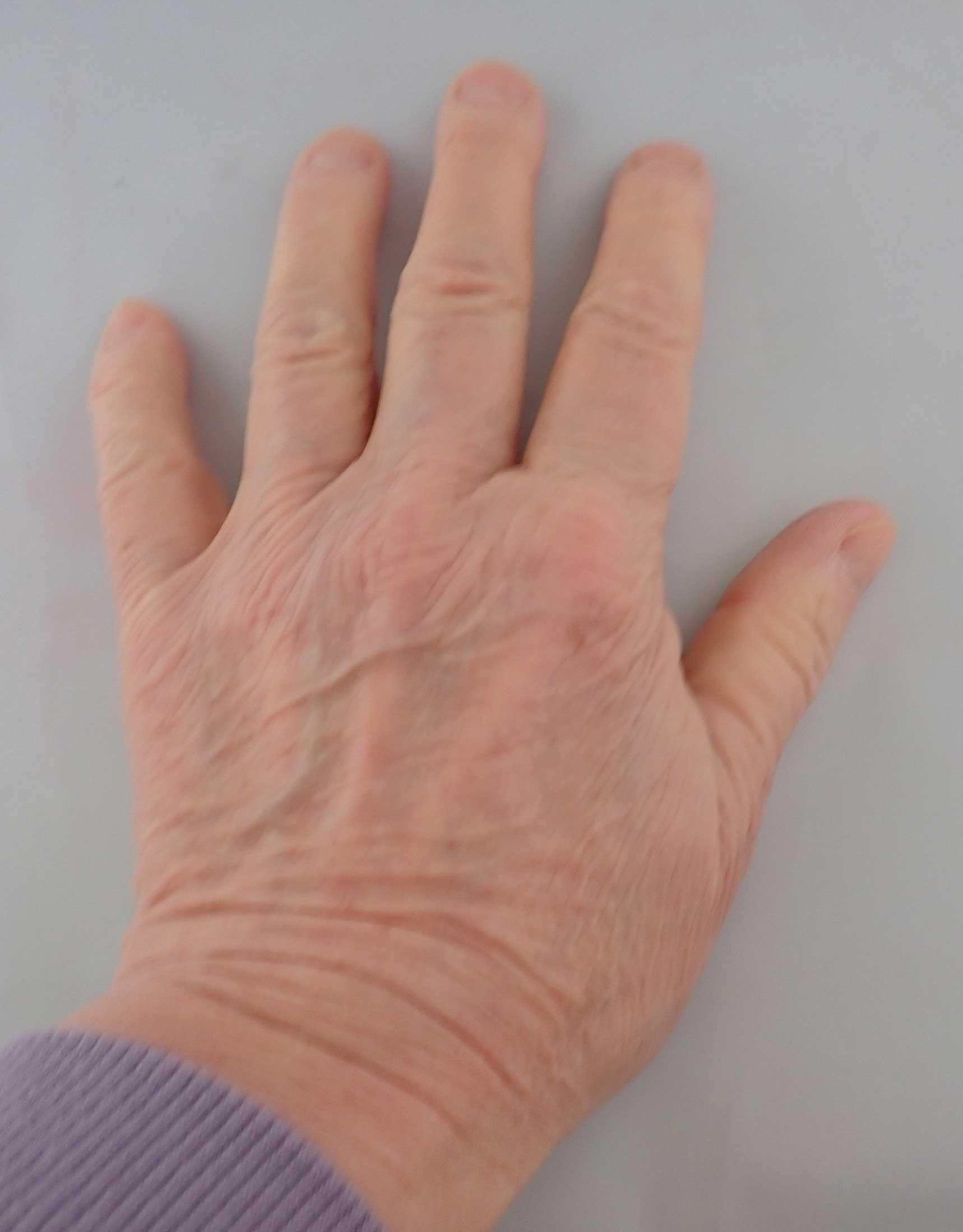 handleftafterDrGundry